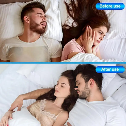 30 60Pieces Anti Snoring Nasal Strips Breathable Physical Nose Expansion Patch Unisex Comfortable Sleep Snoring Relief Care Accessory